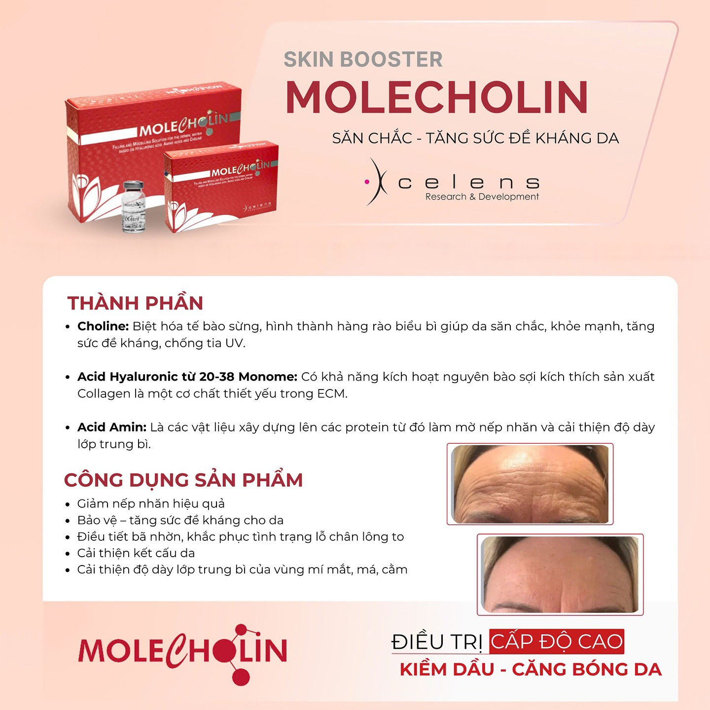 /storage/product/7/xcelens-molecholin-thanh-phan.jpg